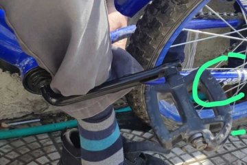 מודיעין עילית: מתנדבי ידידים חילצו בשלום רגל של ילד שנתקעה באופניו