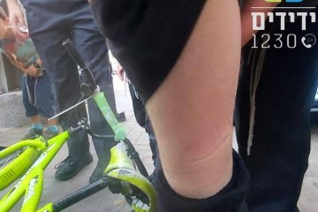בני ברק: רגלו של ילד נלכדה בגלגל אופניים, מתנדבי ידידים חילצו אותה בבטחה