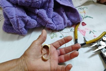 תל אביב: בשעת לילה, שתי טבעות נתקעו על אצבע של גברת – מתנדבי ידידים חתכו את הטבעות וחילצו את האצבע בשלום