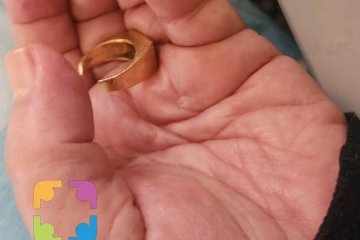 פסגת זאב: טבעת נתקעה על אצבע של אשה מבוגרת, מתנדב ידידים הסיר את הטבעת בהצלחה • “כמה מרגש לסייע גם בדרך חזור לבסיס”