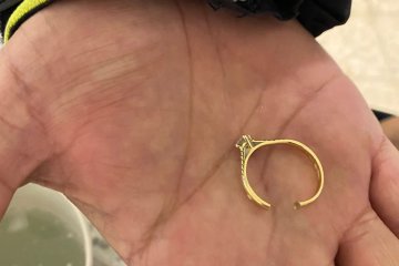 תל אביב: טבעת נתקעה באצבעה של אישה, מתנדבי ידידים חילצו אותה בשלום • צפו🎥
