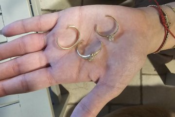 נס ציונה: שלוש טבעות נתקעו על אצבע של אישה, מתנדב ידידים חילץ אותן בשלום