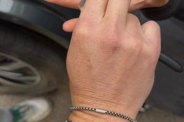 באר שבע: טבעת נתקעה באצבעה של ילדה – מתנדב ידידים חילץ אותה בשלום • ״האמא הופתעה מהמהירות והאבא לא הפסיק לברך״ • צפו 🎥