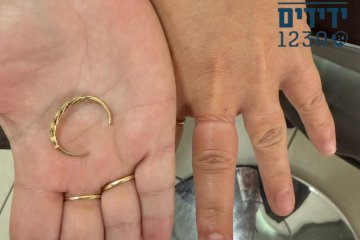 עפולה: טבעת נתקעה באצבעה של אישה – סמנכ”ל ידידים חילץ אותה בשלום • “הגברת התקשרה אלינו בזכות חילוצים קודמים”