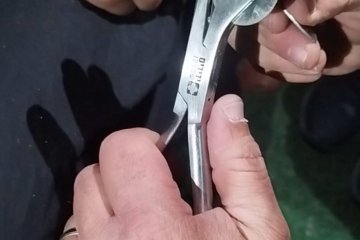 חורה: טבעת נתקעה על אצבע של נערה, מתנדבי ידידים חילצו את הטבעת מהאצבע בשלום • ״תחושה עילאית של סיפוק לראות את הנערה מחייכת לאחר שהוקל לה״
