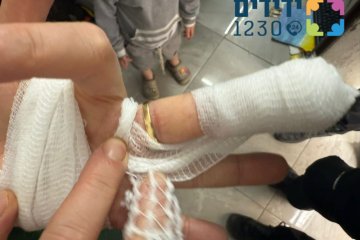 זכרון משה: טבעת שנתקעה על אצבע של גברת, הוסרה במהירות על ידי מתנדבי יחידת האופנועים של ידידים