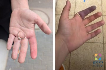 חולון: טבעת של אישה נתקעה באצבעה – מתנדב ידידים חילץ אותה בשלום • ״סיפוק גדול לסייע במיוחד בחילוץ לא פשוט״ • צפו 🎥