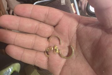 בית שמש: שתי טבעות נתקעו על אצבע של אישה, מתנדבי ידידים חילצו את האצבע מן הטבעות בשלום • “הם אמרו שאפילו יהלומן מקצועי לא הצליח”