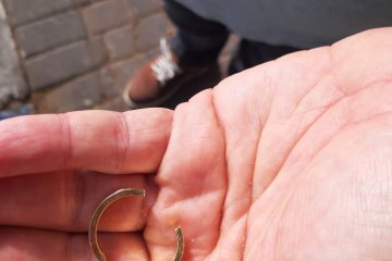 רחובות: טבעת נתקעה על אצבעו של גבר וחולצה בשלום על ידי מתנדב ידידים • “ניסה לחלץ בכל דרך ולבסוף התקשר לידידים שהגיעו במהירות”