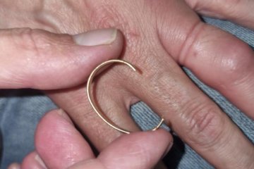 מעלה גלבוע: טבעת נתקעה באצבעו של גבר, סג”מ סניף בית שאן שחרר אותה בהצלחה