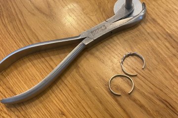 בית שמש: שתי טבעות של אישה בהיריון נתקעו באצבעה – מתנדב ידידים חילץ אותה בשלום • ״הגברת ומשפחתה לא הפסיקו להודות ותרמו לארגון״