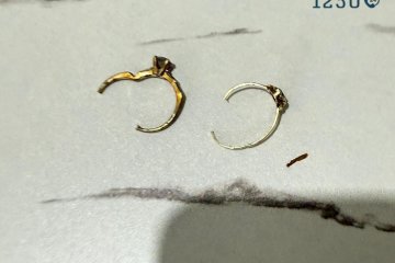 נתיבות: זוג טבעות נתקעו על אצבעה של גברת, מתנדבי ידידים שחררו אותן בהצלחה