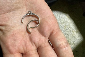 תלפיות: טבעת נתקעה באצבעה של אישה, מתנדב ידידים שחרר אותה בשלום • ״זכות לעזור מיד עם צאת יום כיפור״