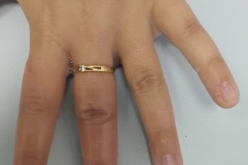 רמת גן: טבעת של ילדה נתקעה באצבעה, מתנדבי ידידים חילץ אותה בשלום