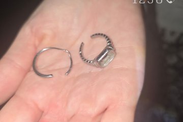 באר שבע: שתי טבעות נתקעו סביב אצבע של גברת, מתנדב ידידים שחרר אותן מהאצבע בשלום