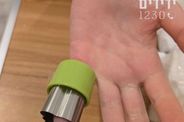 בית חלקיה: קוֹרְצָן בצק נתקע באצבעה של נערה, מתנדב ידידים חילץ את האצבע בשלום • ״ברגע שהקוֹרְצָן הוסר מהאצבע, הורגשה אנחת רווחה גדולה, כולם שמחו והודו מאוד״