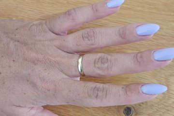 הרצליה: טבעת נתקעה באצבעה של אישה, מתנדבת ידידים חילצה אותה בשלום