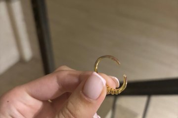 רמלה: טבעת נתקעה באצבעה של נערה, מתנדב ידידים חילץ אותה בשלום