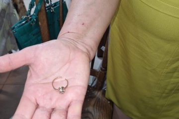 ראשון לציון: טבעת נתקעה באצבעה של אישה, מתנדב ידידים חילץ אותה בשלום