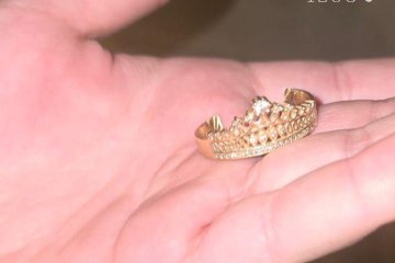 נשר: טבעת נתקעה סביב אצבע של גברת, מתנדבי ידידים חילצו את האצבע בשלום • צפו 🎥