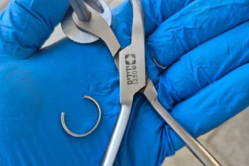 חריש: טבעת נתקעה באצבעה של אישה, מתנדב ידידים חילץ אותה בשלום