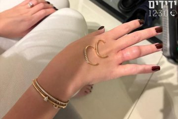 רמלה: שתי טבעות נתקעו באצבעה של אישה, מתנדבי ידידים חילצו אותם בשלום