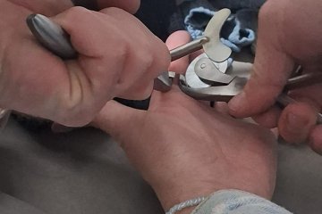 בית שמש: טבעת נתקעה באצבעה של אישה, מתנדבי ידידים חילצו אותה בשלום