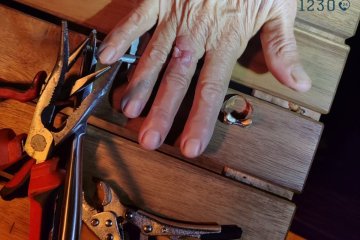 תמרת: טבעת נתקעה סביב אצבע של גברת, מתנדבי ידידים חילצו את האצבע בשלום