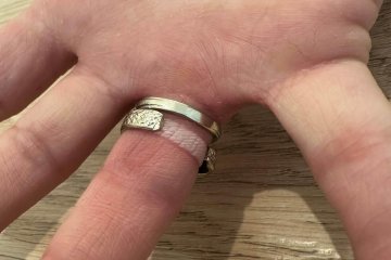 משכנות האומה: טבעת נתקעה סביב אצבעה של גברת בהריון, מנהל הדרכות מחוז ירושלים חילץ את האצבע בשלום • צפו 🎥