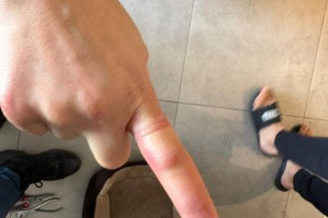 באר שבע: טבעת נתקעה באצבעה של גברת – מתנדב ידידים חילץ אותה בשלום • ״האצבע הייתה אדומה ונפוחה כולה״