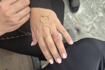 בני ברק: שתי טבעות נתקעו באצבעה של אישה בהריון מתקדם, מתנדב ידידים חילץ אותן בשלום