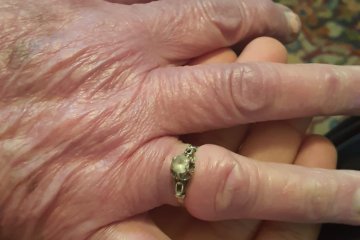 תל אביב: טבעת של אישה מבוגרת נתקעה באצבעה – מתנדב ידידים שחרר את הטבעת וחילץ את האצבע בשלום • “מעבר לחילוץ הטבעת, הרגעתי את הגברת בת ה- 90”