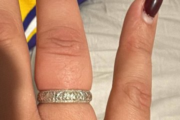 אופקים: טבעת נתקעה באצבעה של גברת – מתנדב ידידים חילץ אותה בשלום • ״הצלת לי את האצבע״