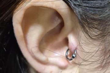 חיפה: עגיל נתקע באוזן של אישה, מתנדבי ידידים חילצו אותו מהאוזן בשלום