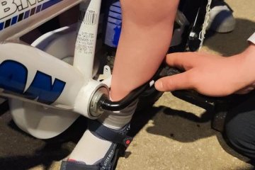 רמת גן: רגלו של ילד נלכדה בדוושת אופניים, מתנדבי ידידים חילצו את הרגל בבטחה