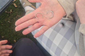 ירקונה: טבעות נתקעו על אצבעה של אישה, מתנדב ידידים חילץ את האצבע בשלום