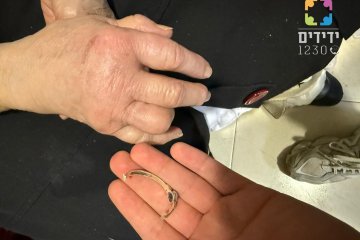 באר שבע: טבעת נתקעה באצבעה של גברת – מתנדב ידידים חילץ אותה בשלום • ״לדעת שעזרתי לאחר ועשיתי לו טוב, זה שווה הכל״