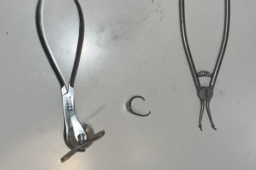 חריש: טבעת נתקעה על אצבעה של אישה וחולצה על ידי מתנדבי ידידים • “מרגש אותי לדעת שאני מסייע ומרגיע”
