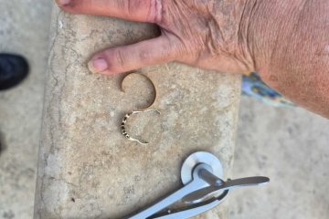 קרית ים: טבעת של אישה נתקעה באצבעה, מתנדב ידידים חילץ אותה בשלום
