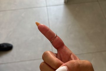 דימונה: טבעת נתקעה באצבעה של גברת – מתנדבי ידידים חילצו אותה בשלום • ״זכות גדולה״