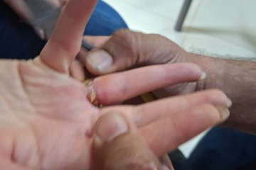 כפר נחף: טבעת נתקעה באצבעה של אישה, וחולצה ע״י מתנדבי ידידים