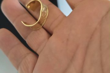 באר שבע: טבעת נתקעה באצבעה של גברת – מתנדבי ידידים חילצו אותה בשלום • ״זימון משמיים לסייע לפני יום כיפור״