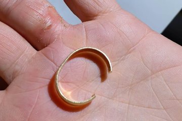 תל אביב: טבעת של גבר נתקעה באצבעו – מתנדב ידידים שחרר את הטבעת וחילץ את האצבע בשלום • “ברגע שנעם תייג קלטתי את קריאת החירום, וישר יצאתי למקום”