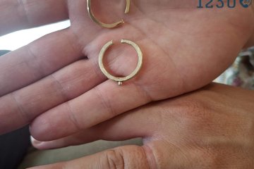 קרית גת: טבעות נתקעו באצבעה של גברת – מתנדבת ידידים חילצה אותה בשלום • ״אלופה שהשם יברך אותך״