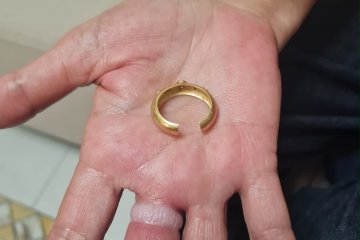 ראשון לציון: טבעת נתקעה באצבעה של אישה, מתנדב ידידים חילץ את האצבע בשלום